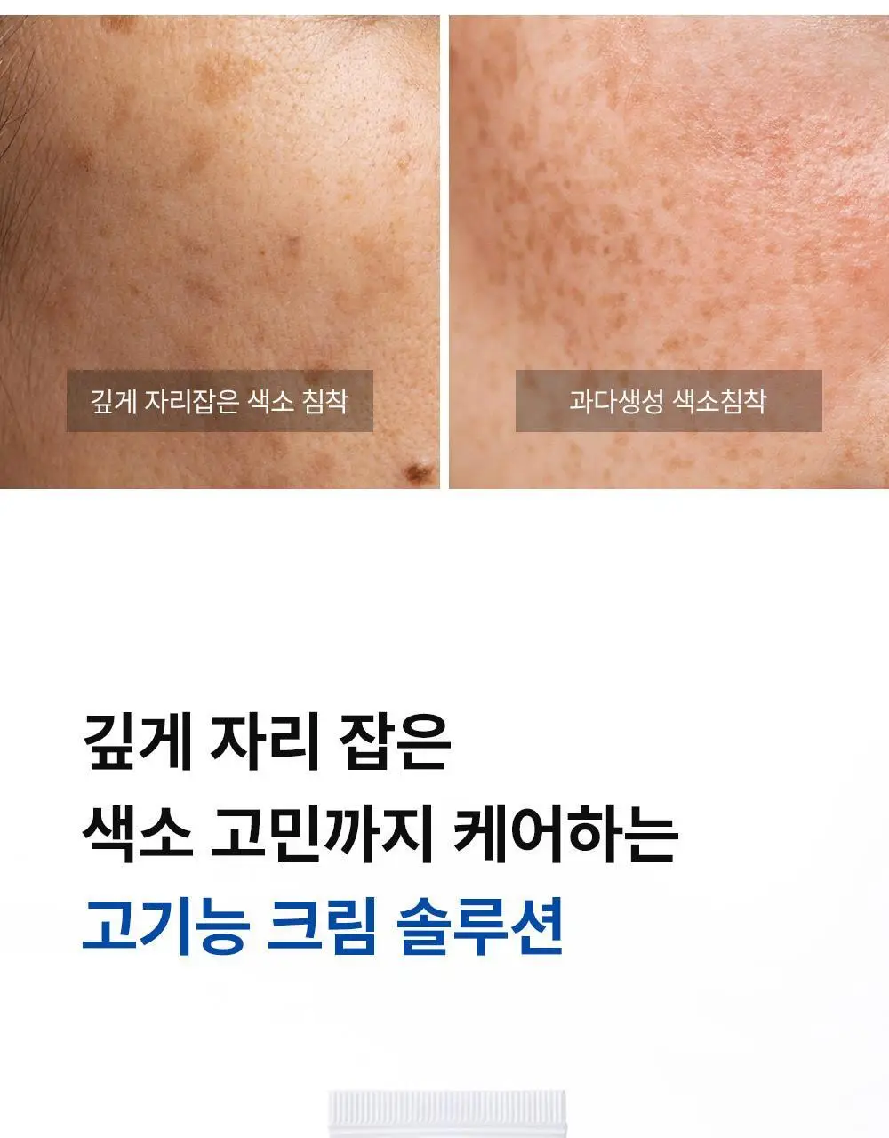 [멜라닌양개선] 동아제약 색소침착 프로 크림제 40ml 상세페이지 7